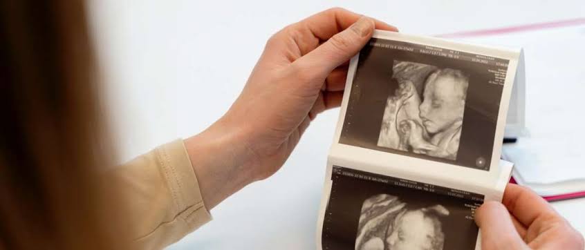 RSUD Soewondo Pati Layani Pemeriksaan Kandungan dengan USG Fetomaternal