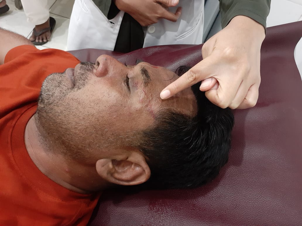 Niat Nonton Dangdut, Warga Sambilawang Malah Babak Belur Dikeroyok Massa