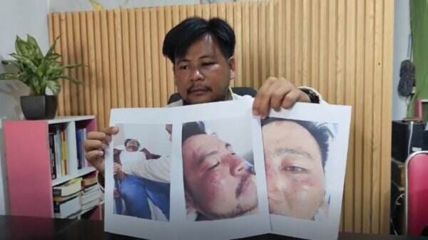 Kuasa Hukum LBHS Teratai Alami Insiden Saat Aksi Demonstrasi di Pati, Begini Pengakuanya